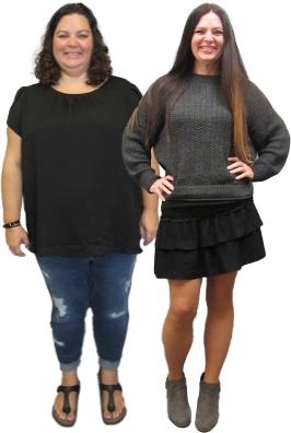 Bariatric patient before and after weight loss surgery