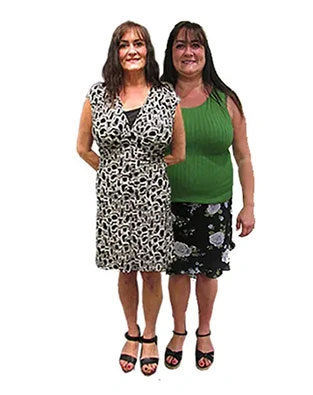 Bariatric patient before and after weight loss